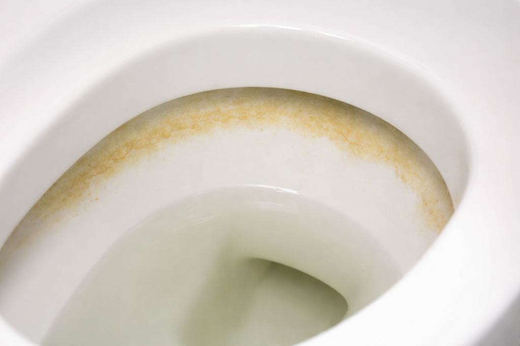 Starker Urinstein unter dem Toilettenrand